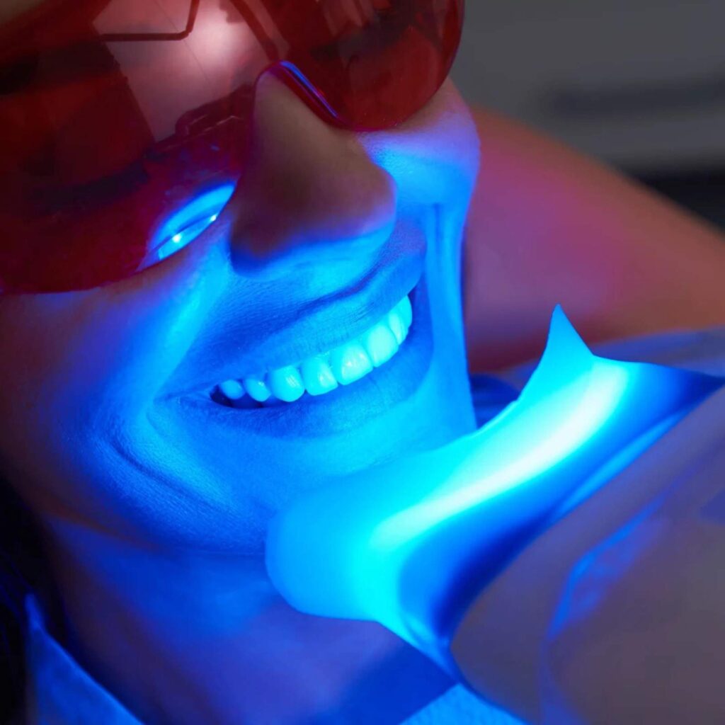 teeth whitening treatment in indore